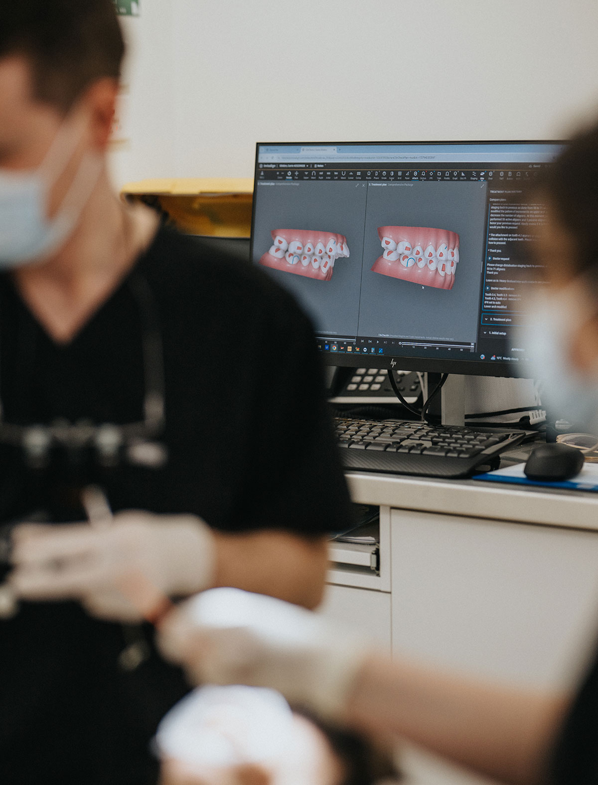 What Can Composite Bonding Address?