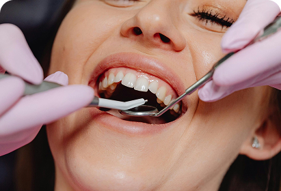 Transform Your Smile with Cosmetic Dentistry in Perth