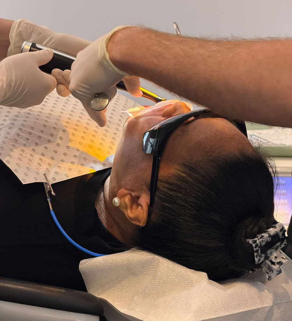 In-chair whitening