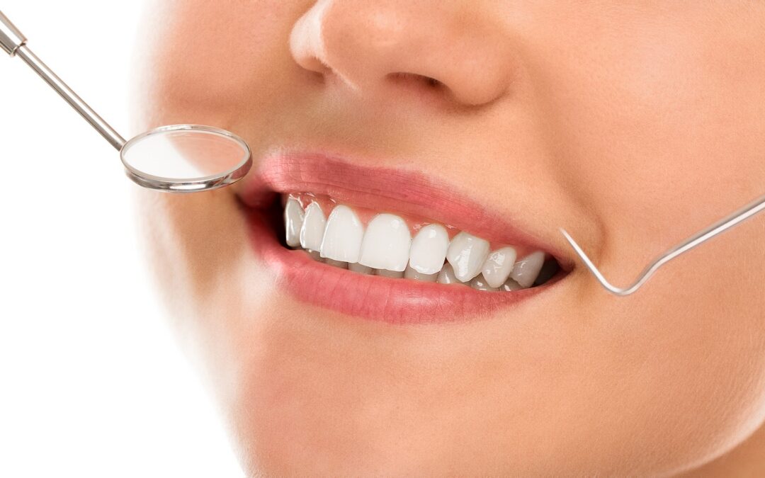 How to Choose the Right Dentist for Your Dental Implant