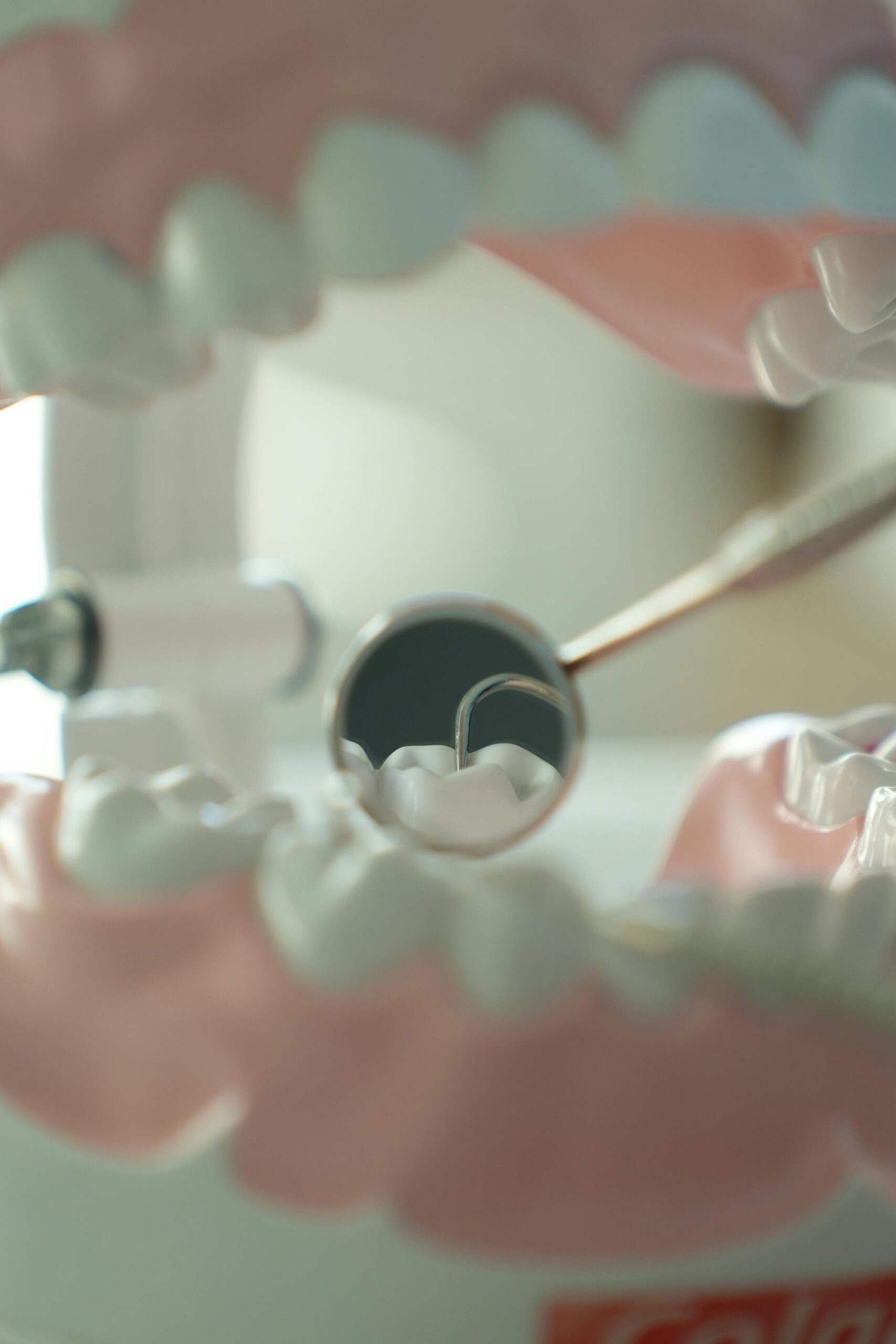 Dental Veneers Done the Right Way!