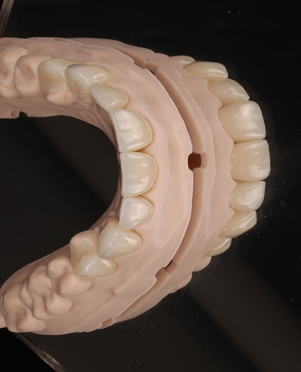 Why Perth Patients Choose Dental 359 for Dental Implants