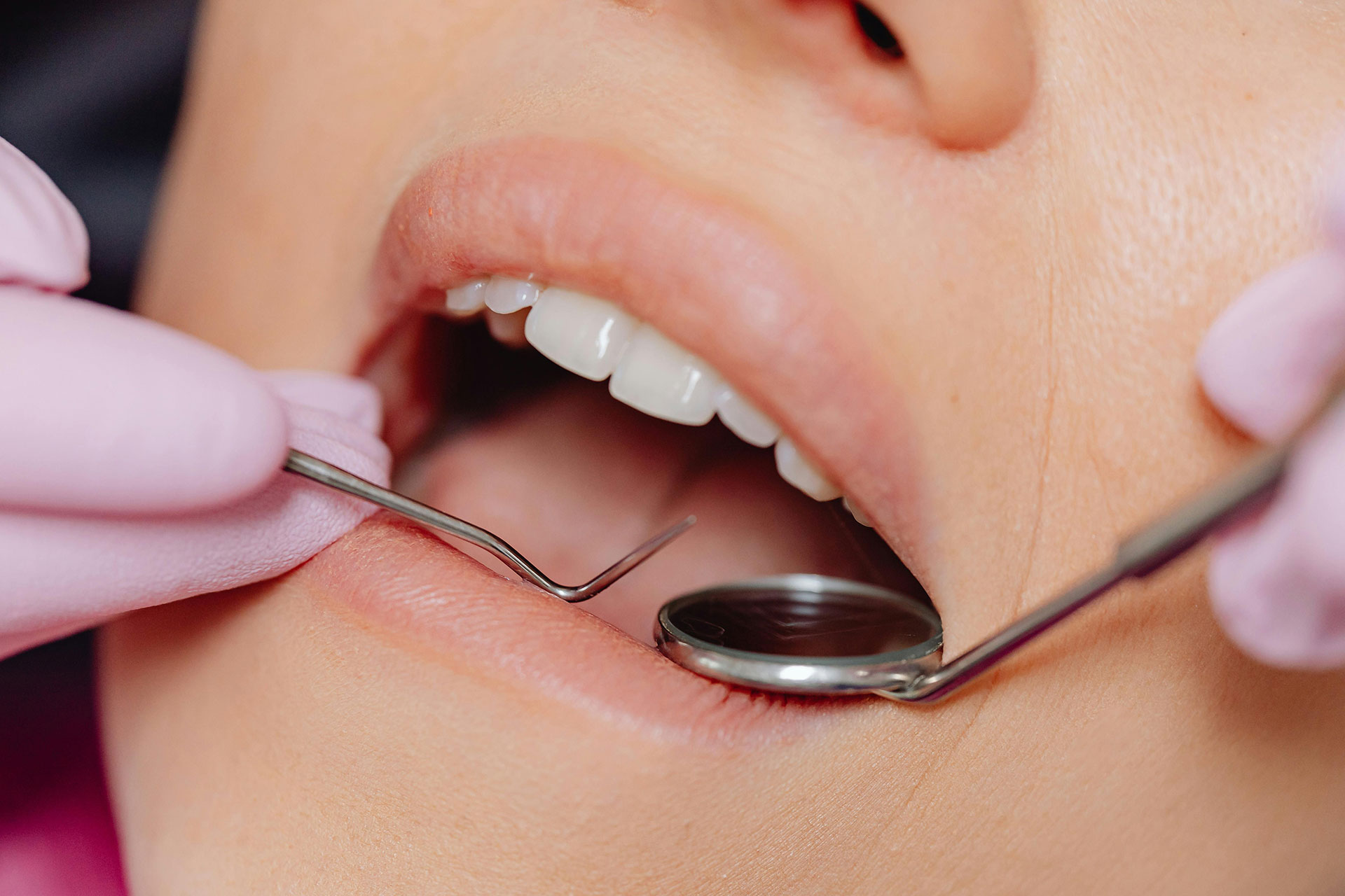 What Happens at a Dental Check-up in Australia?